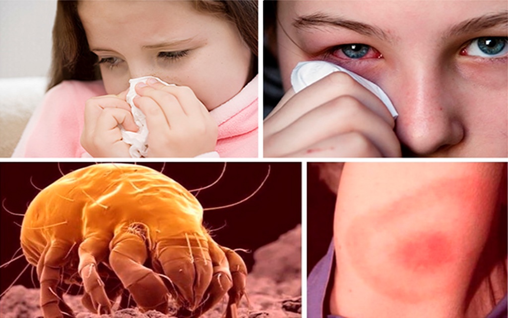 allergie aux acariens