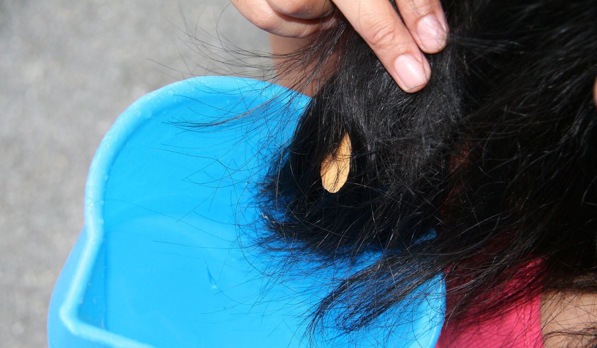 como remover chiclete do cabelo com gelo foto