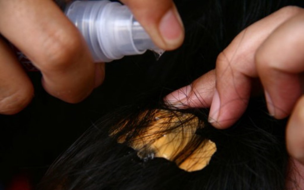 como remover chiclete do cabelo com gotas de silicone