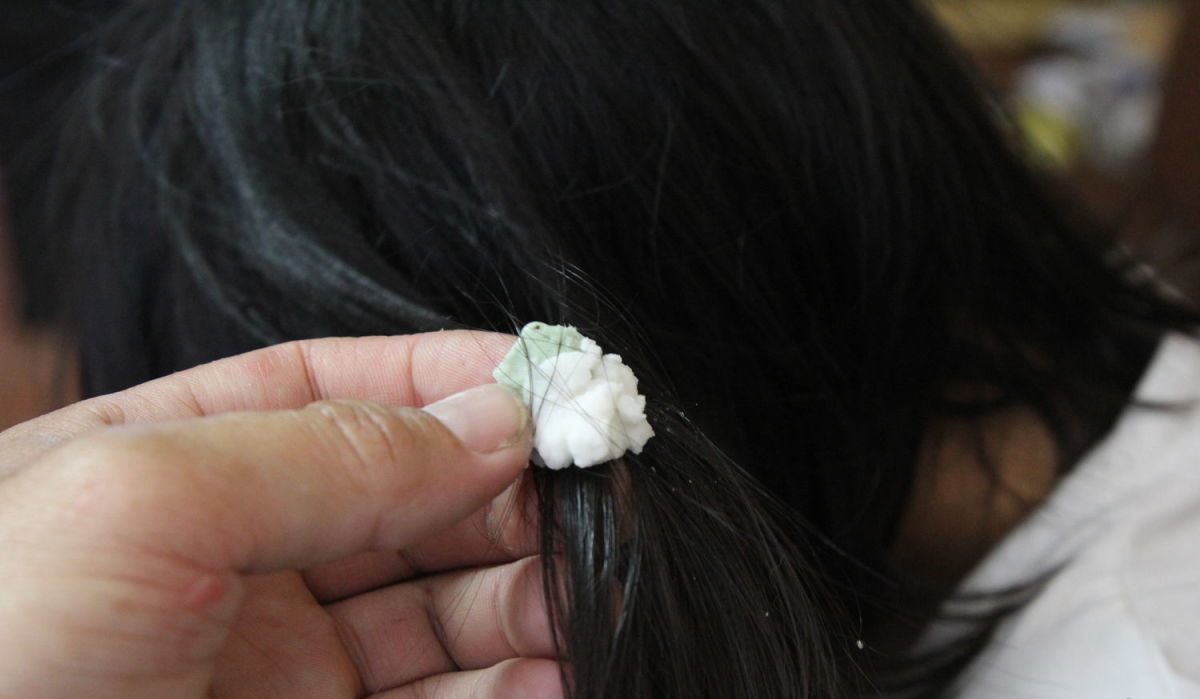 foto de goma no cabelo